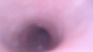 look inside urethra and bladder with endoscope