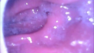 Endoscope camera inside my ass