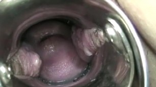OPEN VAGINA, DOUBLE ORGASM OF VISIBLE DROP OF BARTHOLINI'S G